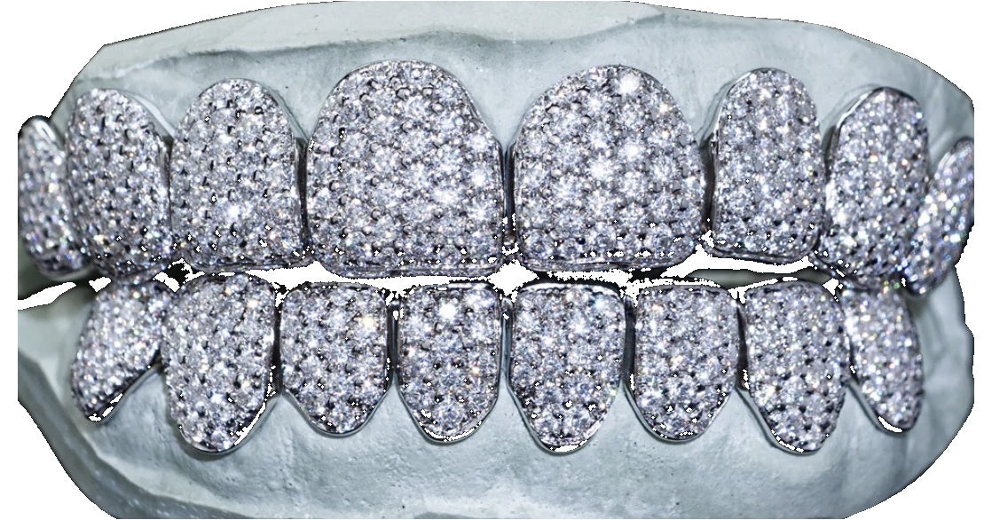 Iced Out Moissanite Grillz – 6 Tooth Full Set (Top or Bottom)