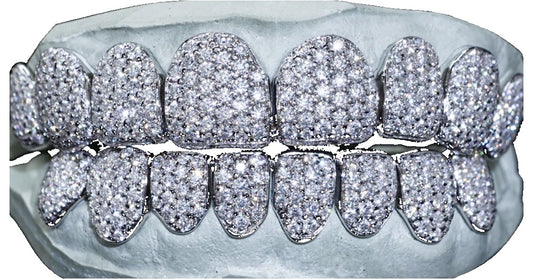 Iced Out Moissanite Grillz – 6 Tooth Full Set (Top or Bottom)